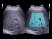 OOO «Sun Gate International» - Ультразвуковой сканер премиум класса Esaote MyLab A70