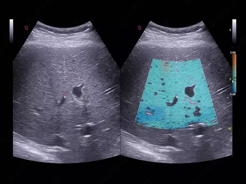 OOO «Sun Gate International» - Ультразвуковой сканер премиум класса Esaote MyLab A70