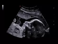 Ультразвуковой сканер премиум класса Esaote MyLab A70 - Диагностическое оборудование