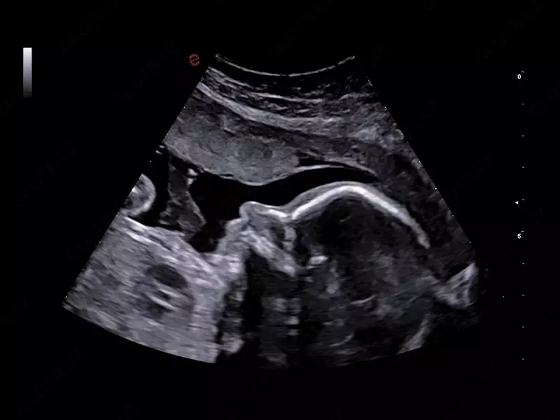 Ультразвуковой сканер премиум класса Esaote MyLab A70 - Диагностическое оборудование