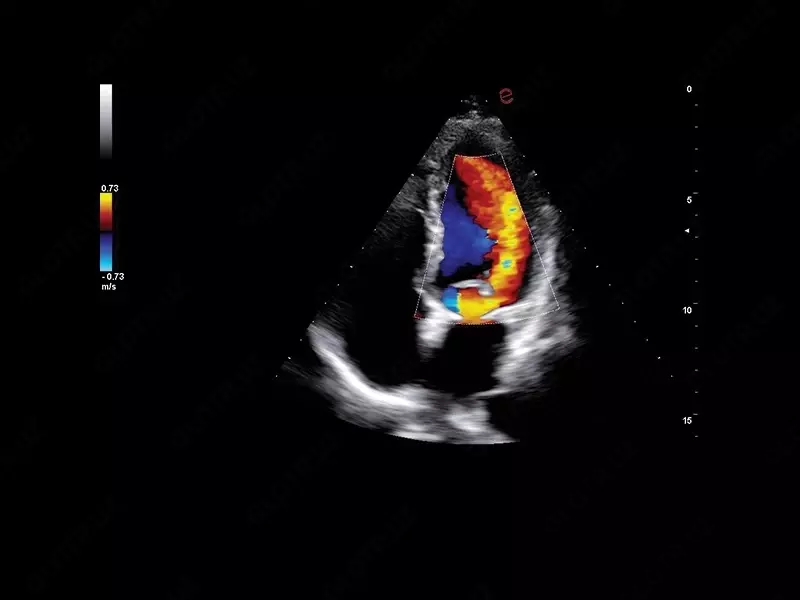 Ультразвуковой сканер премиум класса Esaote MyLab A70 Диагностическое оборудование