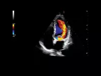 Ультразвуковой сканер премиум класса Esaote MyLab A70 Диагностическое оборудование