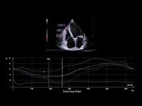 Ультразвуковой сканер премиум класса Esaote MyLab A70 от 538 345 350 сум - OOO «Sun Gate International»