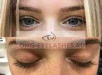 150 000 so'm Kirpik o'sishi va kareprost Plus ni kuchaytirish