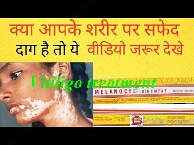 114 000 сум / шт. Мазь Меланоцил (Melanocyl) от витилиго