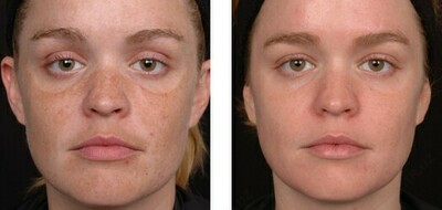 99 000 сум / шт. Крем отбеливающий Expigment