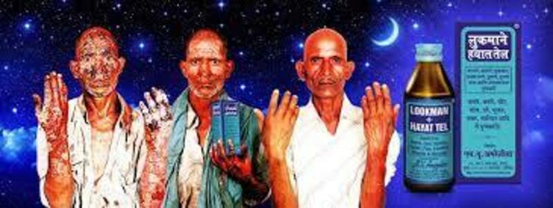 "Lookman-E-Hayat Tel" Teri kasalliklari uchun davolovchi sarum Chakana savdo