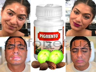 150 000 so'm / dona Vitiligo davolash uchun pigmento tabletkalari