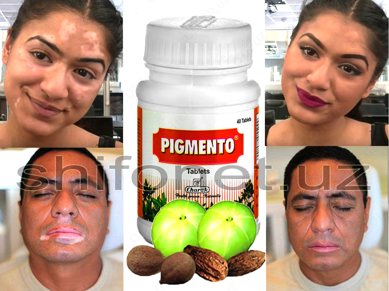 Таблетки Пигменто для лечение витилиго