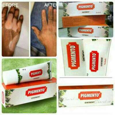 150 000 so'm / dona Vitiligo davolash uchun pigmento moyi