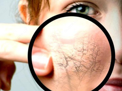 Клирвин (против пятен прыщей и шрамов на коже) Только в розницу