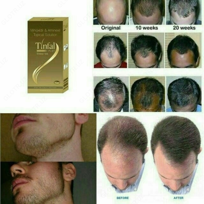 Спрей от выпадения волос Tinfal plus