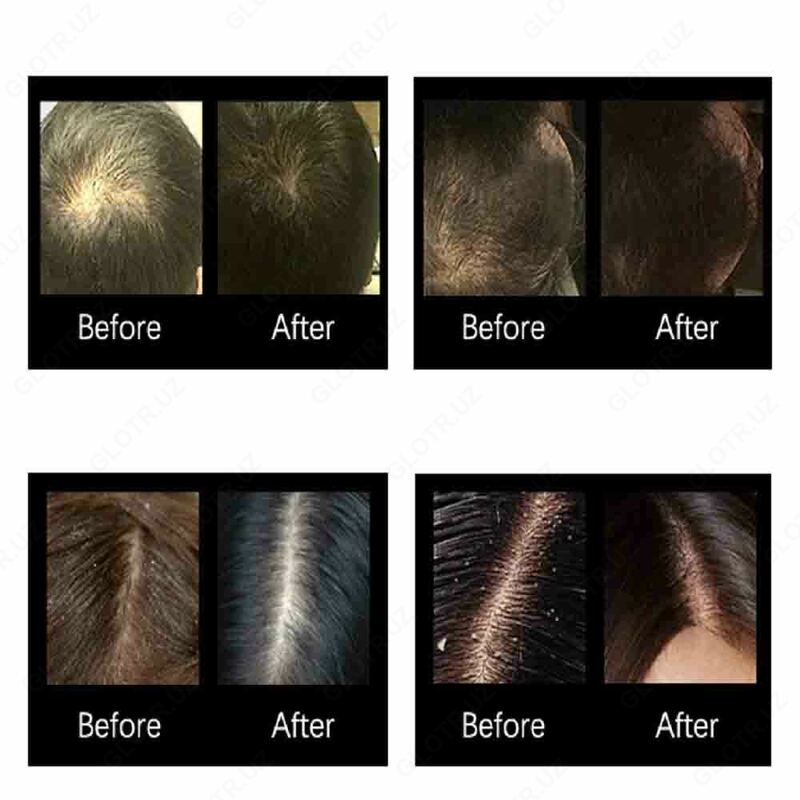 Масло для волос Miracle hair oil