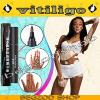 LILSHOP.UZ - Тональный фломастер от Витилиго Zanderm Vitiligo Concealer
