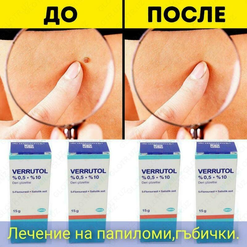 Papillomalarni olib tashlash uchun Verrutol (Verrutol) - 150 000 so'm