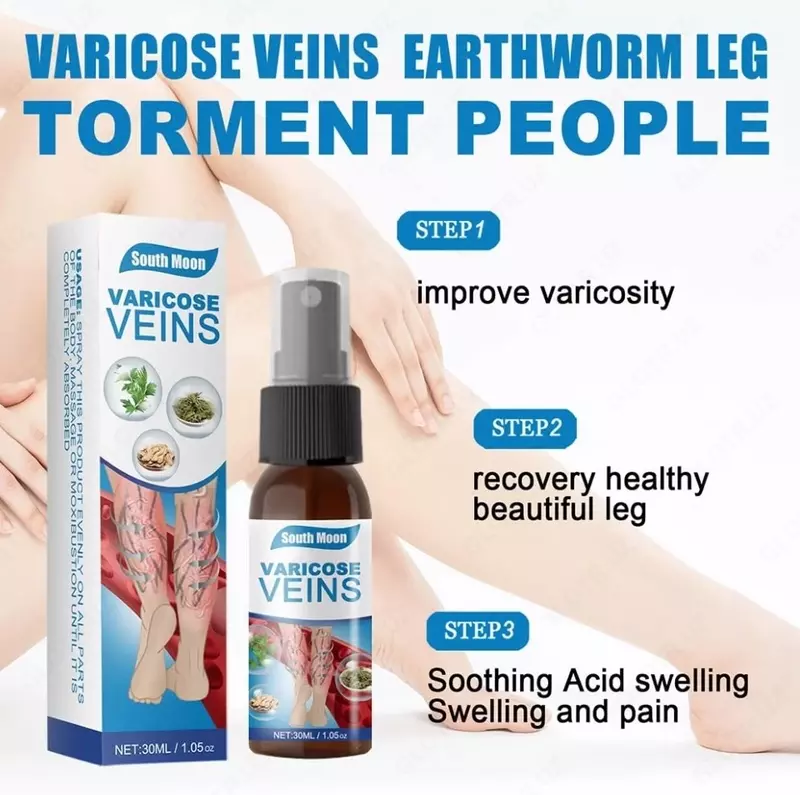 Varikoz tomirlari uchun buzadigan amallar