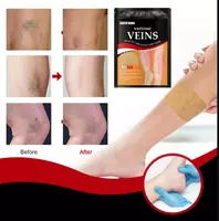 Антиварикозные патчи Varicose Veins от South Moon