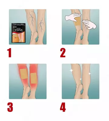 13 000 сум / шт. Антиварикозные патчи Varicose Veins от South Moon