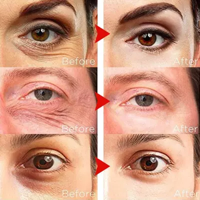 Крем с коллагеном для ухода за кожей вокруг глаз Крем с коллагеном для ухода за кожей вокруг глаз