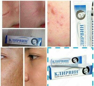 Clearvin kremi bilan birga silliq va toza teri (Klirvin)