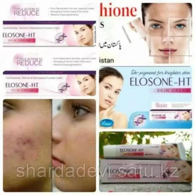 ПРЫЩЕЙ И МОРЩИН ЭЛОЗОН/ELOSONE-HT