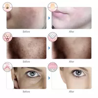  Светодиодная LED-маска для лица Домашний Уголок