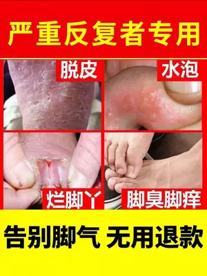 Спрей от пота ног Волк помогает: ликвидировать стойкий запах пота;