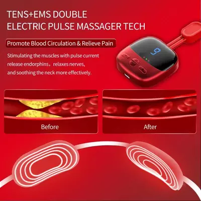 180 000 сум / шт. Электрический импульсный массажер для облегчения боли в тканях