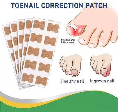 Патчи для ногтей Fitmedify - корректирующие патчи для красивых и здоровых ногтей