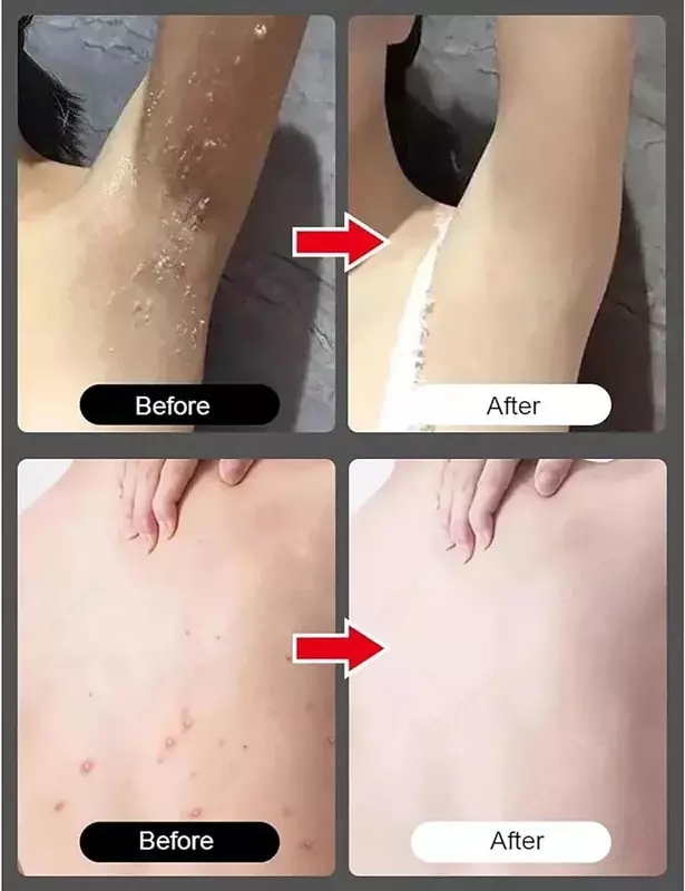 Мгновенный отбеливающий отшелушивающий гель для тела: крем с амидной глиной