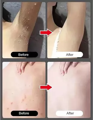 Мгновенный отбеливающий отшелушивающий гель для тела: крем с амидной глиной Только в розницу