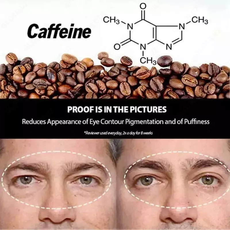 Мужской пептидный лифтинг-гель (крем) для глаз OPENEYES Awaken Peptide