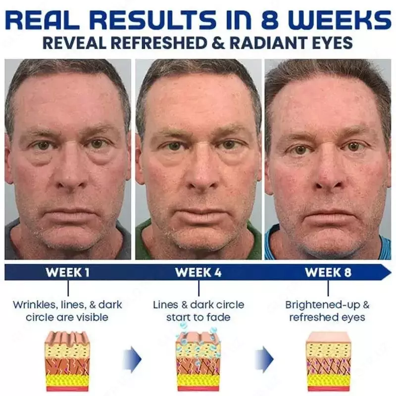 Мужской пептидный лифтинг-гель (крем) для глаз OPENEYES Awaken Peptide