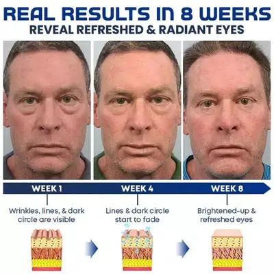 Мужской пептидный лифтинг-гель (крем) для глаз OPENEYES Awaken Peptide