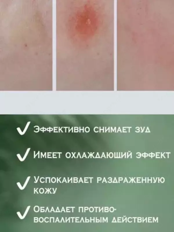 Портативный бальзам после укусов насекомых «Окопник таун»