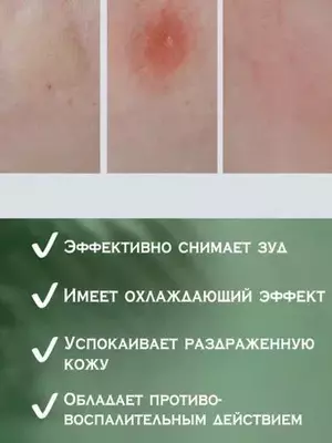 30 000 so'm / dona Портативный бальзам после укусов насекомых «Окопник таун»