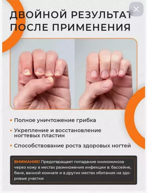 Препарат-сыворотка XI FEI SHIXi Fei Shi от грибка ногтей (15 мл.) "Domashniy ugolok" XK