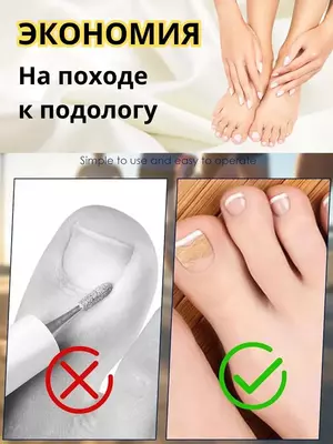 Наклейки для коррекции вросшего ногтя (50 шт). - 60 000 сум / шт