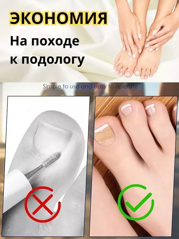 Наклейки для коррекции вросшего ногтя (50 шт).