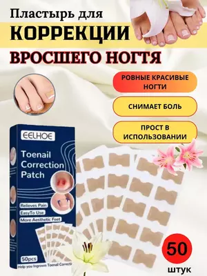 Наклейки для коррекции вросшего ногтя (50 шт). ЯТТ "Домашний Уголок"