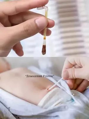 Ватные палочки с йодом (25 шт)