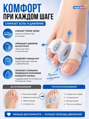 Силиконовый корректор для косточки большого пальца Hallux Valgus,разделитель пальцев, 2 шт.