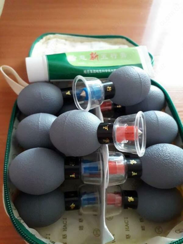  Магнитные массажные присоски банки акупунктурного действия - 