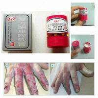  Китайская мазь Король кожи Davoshop.uz