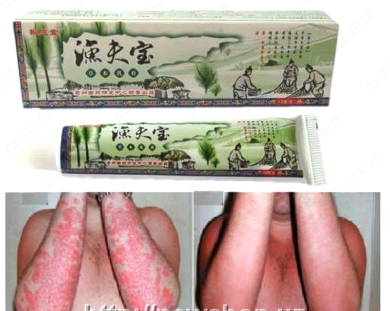   Мазь от псориаза Сокровище рыбака