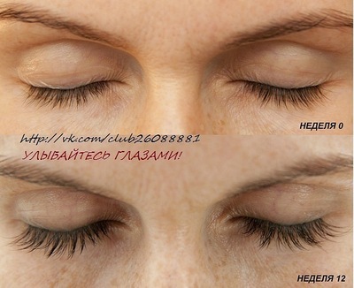 Средство для роста ресниц Careprost Plus