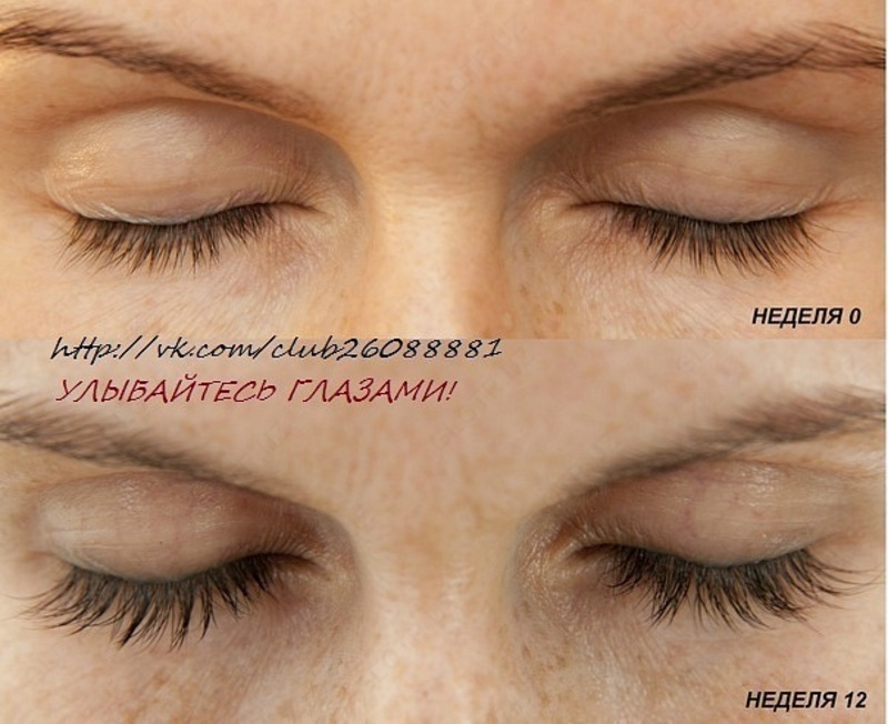 Средство для роста ресниц Careprost Plus - Прочая косметика