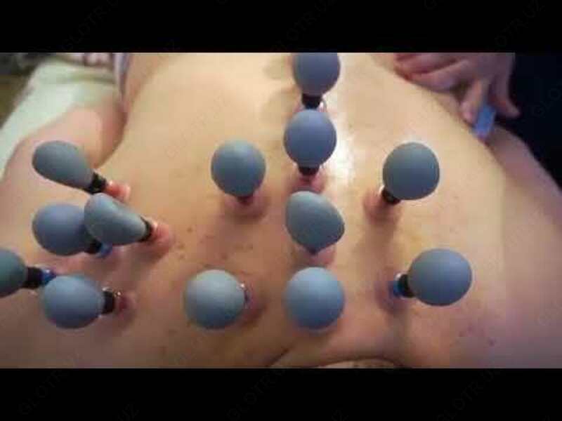 Вакуумные банки магнитные акупункционного действия