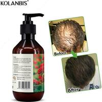 Zanjabil zanjabil sochlari uchun shampun