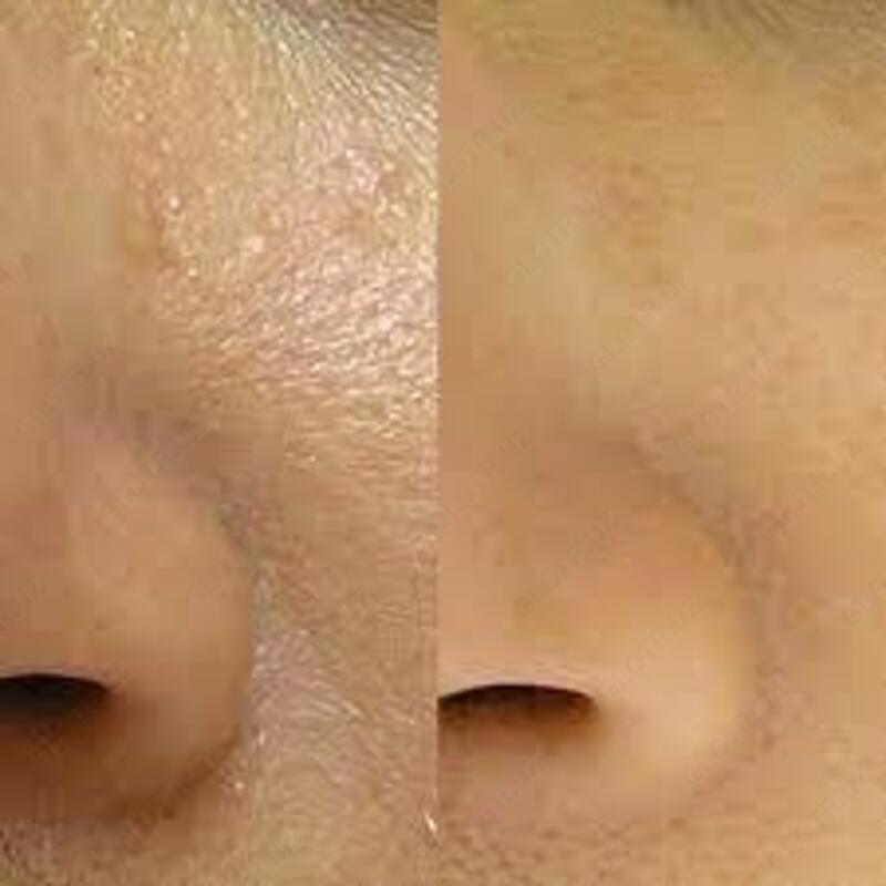 Очищающее средство Amino Acid Cleansing Foam Moisturizing Oil Control